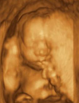 Ultrazvuk - Výraz miminka v bříšku může napovídat o psychické pohodě matky